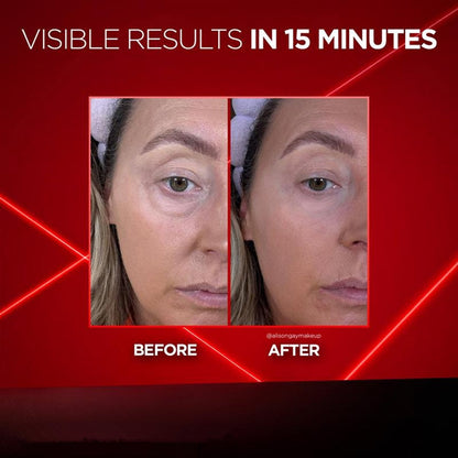 Eye Bag Instant Eraser, Tightens, Firms, & Blurs Wrinkles